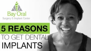 5 reasons for dental implants