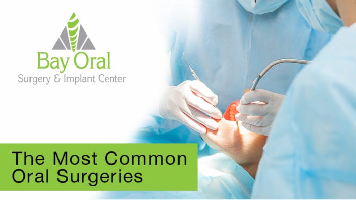 BLOG-PHOTO-TEMPLATE_Most-Common-Oral-Surgeries - Bay Oral Surgery ...